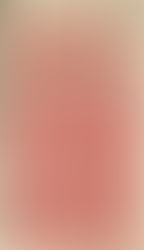 Variété inconstante par "gommette"