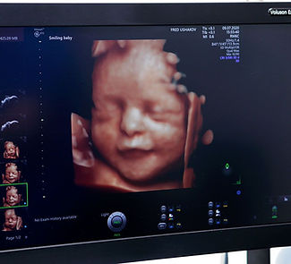 Banner-3rd-TRIMESTER-ANOMALY-SCAN-8cb1c2e7.jpeg