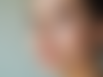 Milia removal Cantik Esthetics Skin Care Surrey,BC