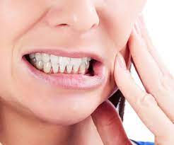 Como saber se tenho bruxismo?