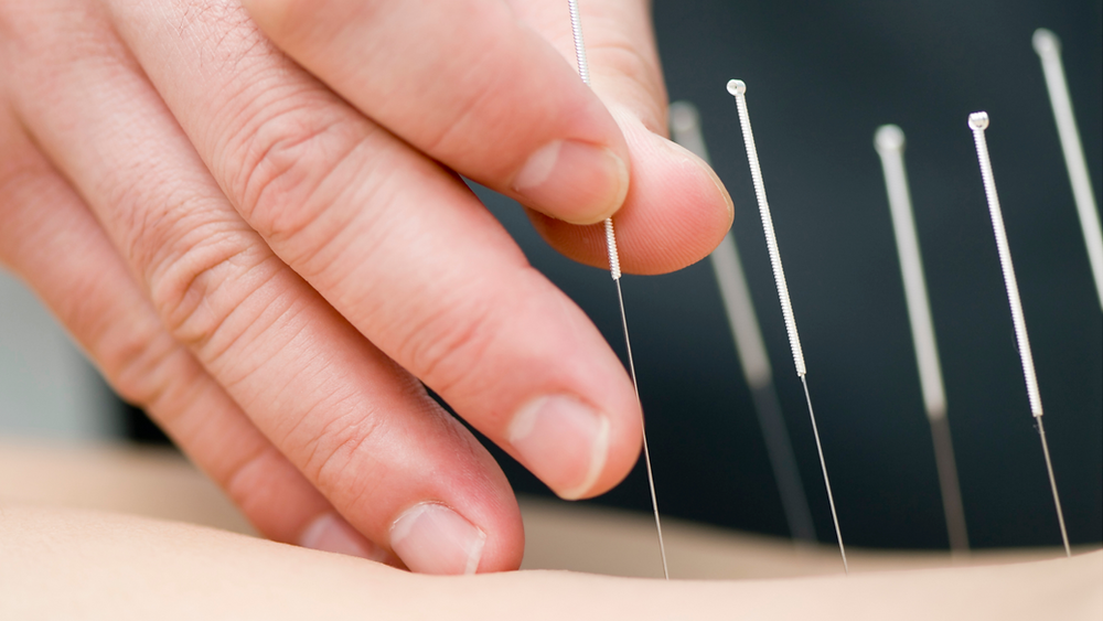 Is Acupuncture Painful?