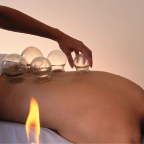 What is cupping? (and what is it used for?) 