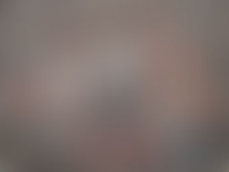 How to Prune Apple Trees in Winter