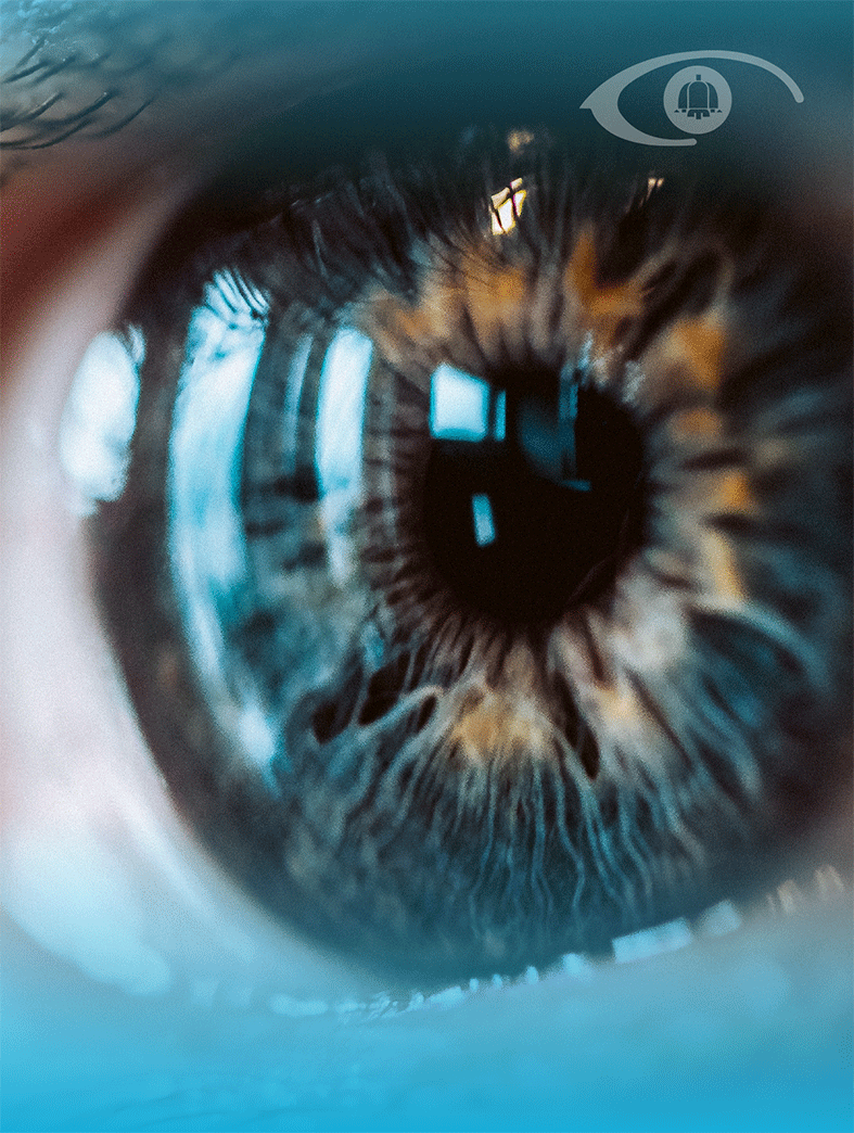 lasik.gif