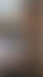 Nutricionista e recomposição corporal: como dieta e treino transformam o corpo do paciente