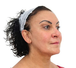 before-and-after-thread-lift (1)