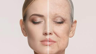 Rejuvenescimento natural com bioestimulador: o que muda na pele (e o que não muda)