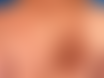 Notalgia Parestésica: Entenda as Causas e Como Tratar a Coceira nas Costas | Dra. Carla Knust