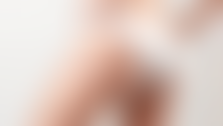 Bioestimulador de colágeno no bumbum: como funciona, resultados e para quem é indicado