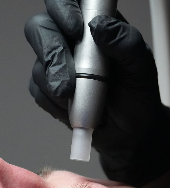 microdermabrasion muenchen.jpg