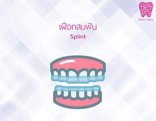 เฝือกสบฟัน (Occlusal Splint) เครื่องมือทันตกรรม แก้ปัญหาบดเคี้ยว