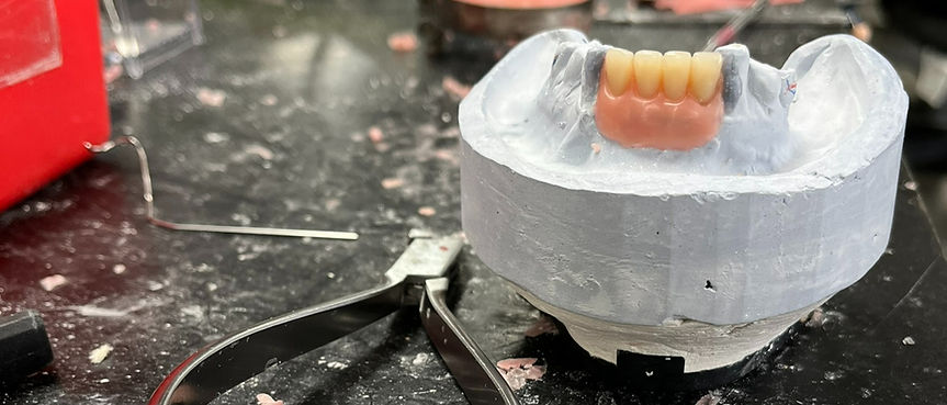 Prototype partial denture on a workbench