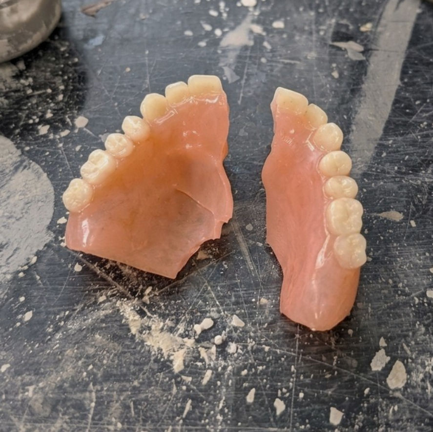 Cracked upper denture.jpg