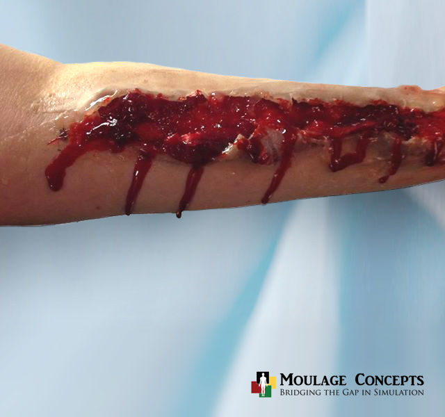 Trauma Moulage Large Laceration