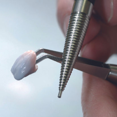 תמונה ממוזערת: קונדנסר - Condenser