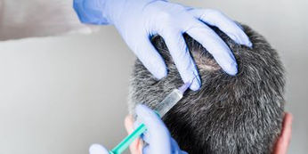 PRP Hair Restoration Therapy.jpeg
