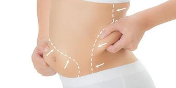 Body Contouring.jpeg