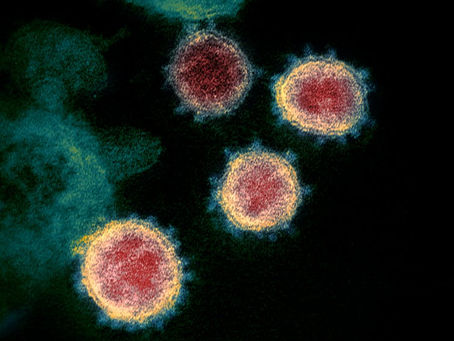 Why you Should Get a COVID-19 Vaccine – Even if You’ve Already Had the Coronavirus