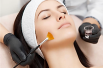 skin-peel.png