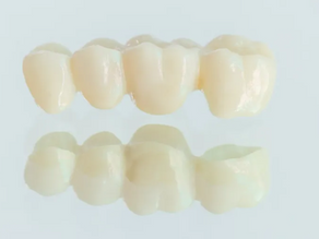 How a Dental Bridge Benefits Your Smile