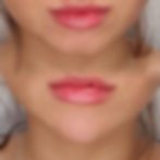 chin filler in Southport