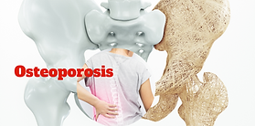 Osteoporosis