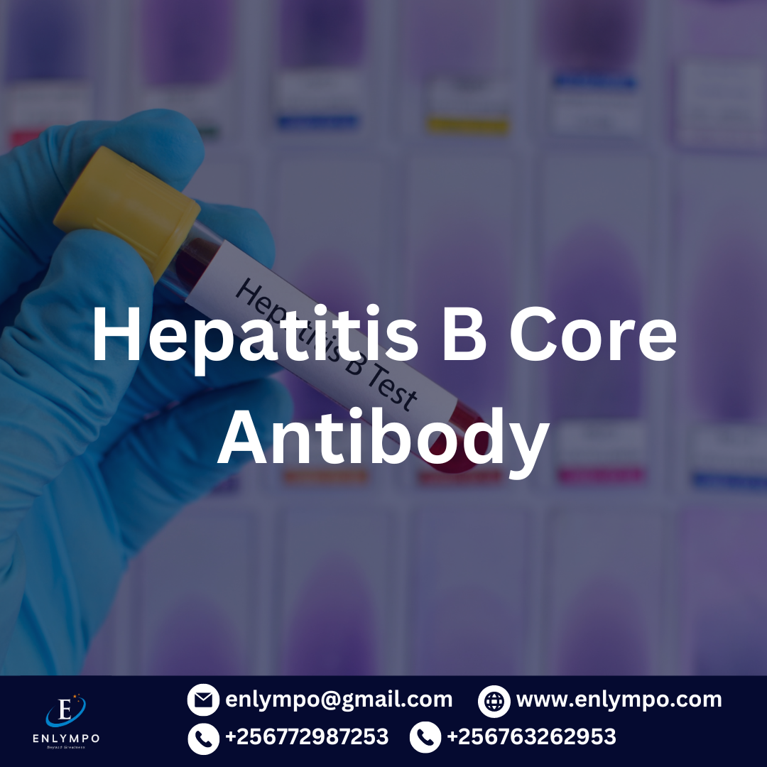 Hepatitis B Core Antibody