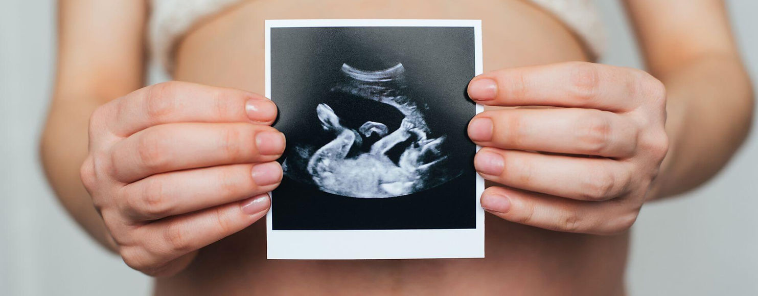 Egg Donor Process Overview.jpg