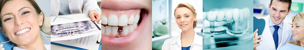 Dental Implant