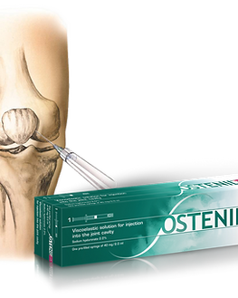 Knee-injection-with-Ostenil-Plus.png