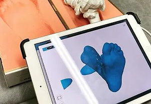 Casting for custom orthoses.jpg