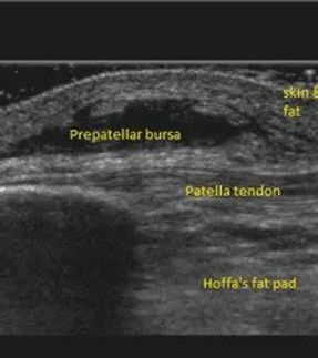 Diagnostic Ultrasound Scan.jpg