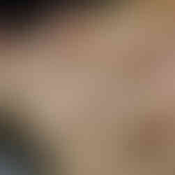 Close-up of a woman receiving a gentle facial massage during a skincare treatment.