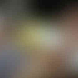 A woman relaxing with a golden facial mask being applied during a skincare treatment.