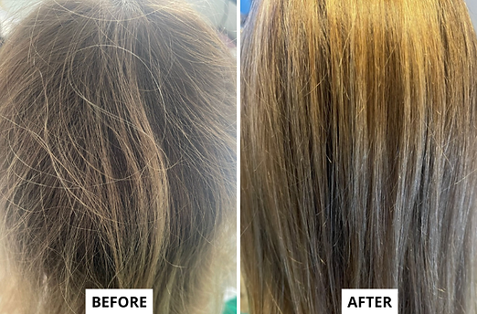 hair-2.png