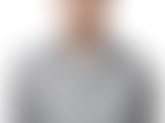 Receding Hairline? Here Could Be Some Potential Causes.