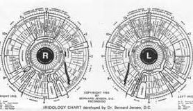 I am doing Iridology again!