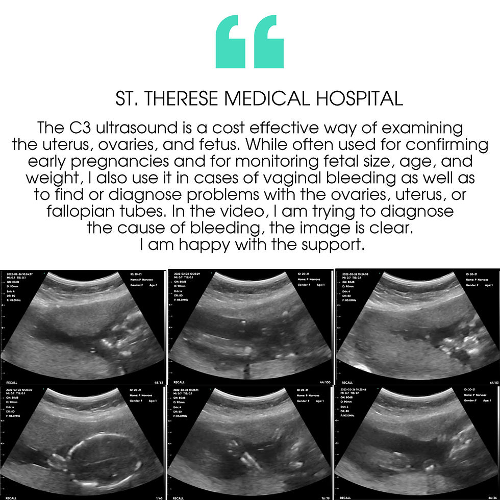Thumbnail: SONOQUE C3 - Wireless Portable Ultrasound Probe