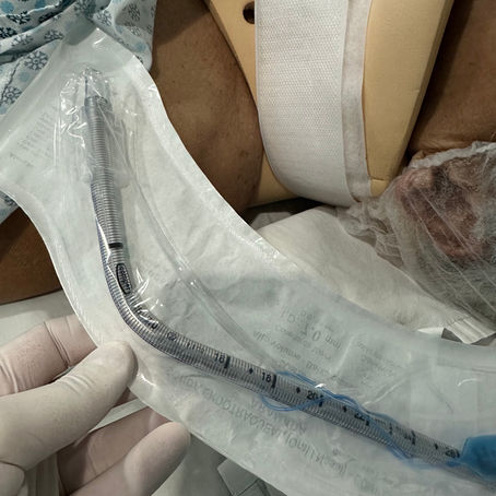 Estratégias para Intubação em Pacientes com Fratura Cervical