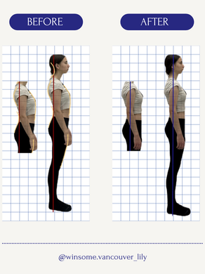 Sway back posture before and after Pilates session showing improved posture alignment, pelvis position, and head-neck alignment at Winsome Pilates in Burnaby.