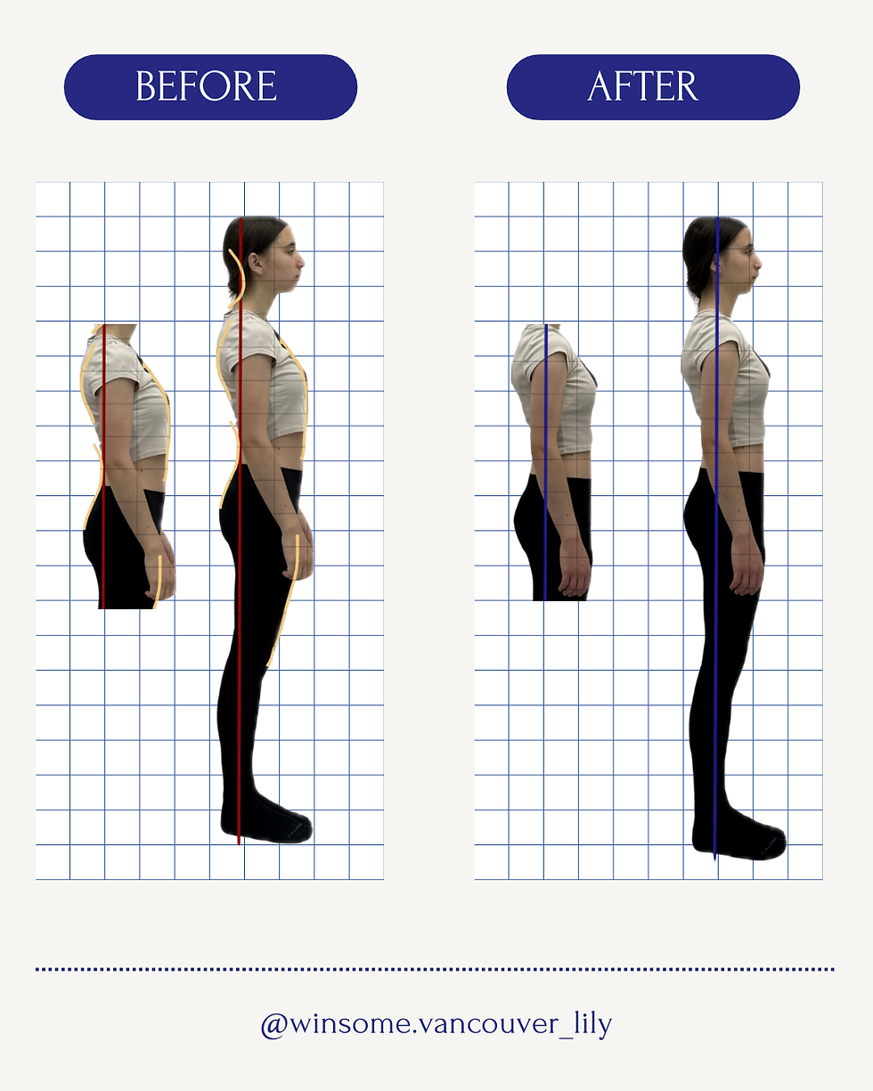 Sway back posture before and after Pilates session showing improved posture alignment, pelvis position, and head-neck alignment at Winsome Pilates in Burnaby.