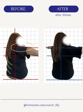 Before and after Pilates posture photo showing improved rotation and alignment after 50 minutes.