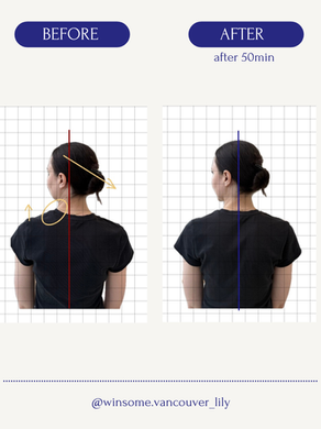 Before and after Pilates posture assessment showing improved neck rotation, shoulder alignment, and upper back posture after a 50-minute session.