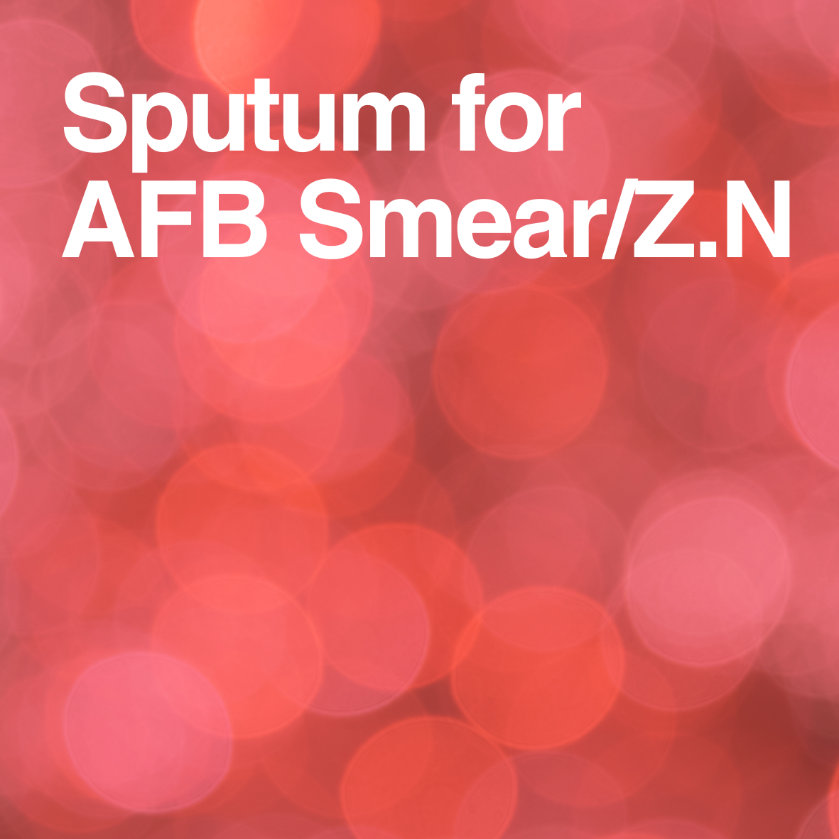 Sputum for AFB Smear/Z.N