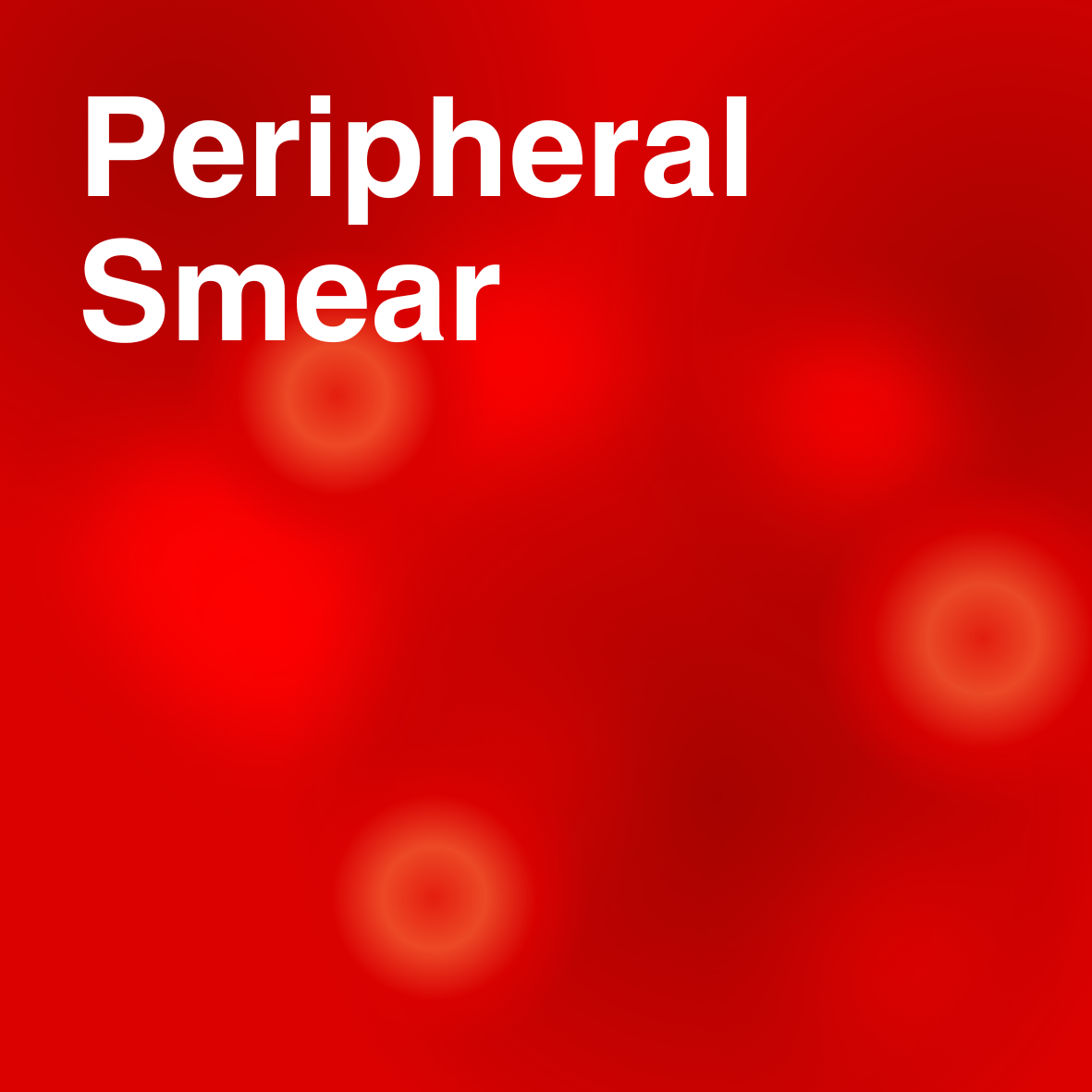 Peripheral Smear