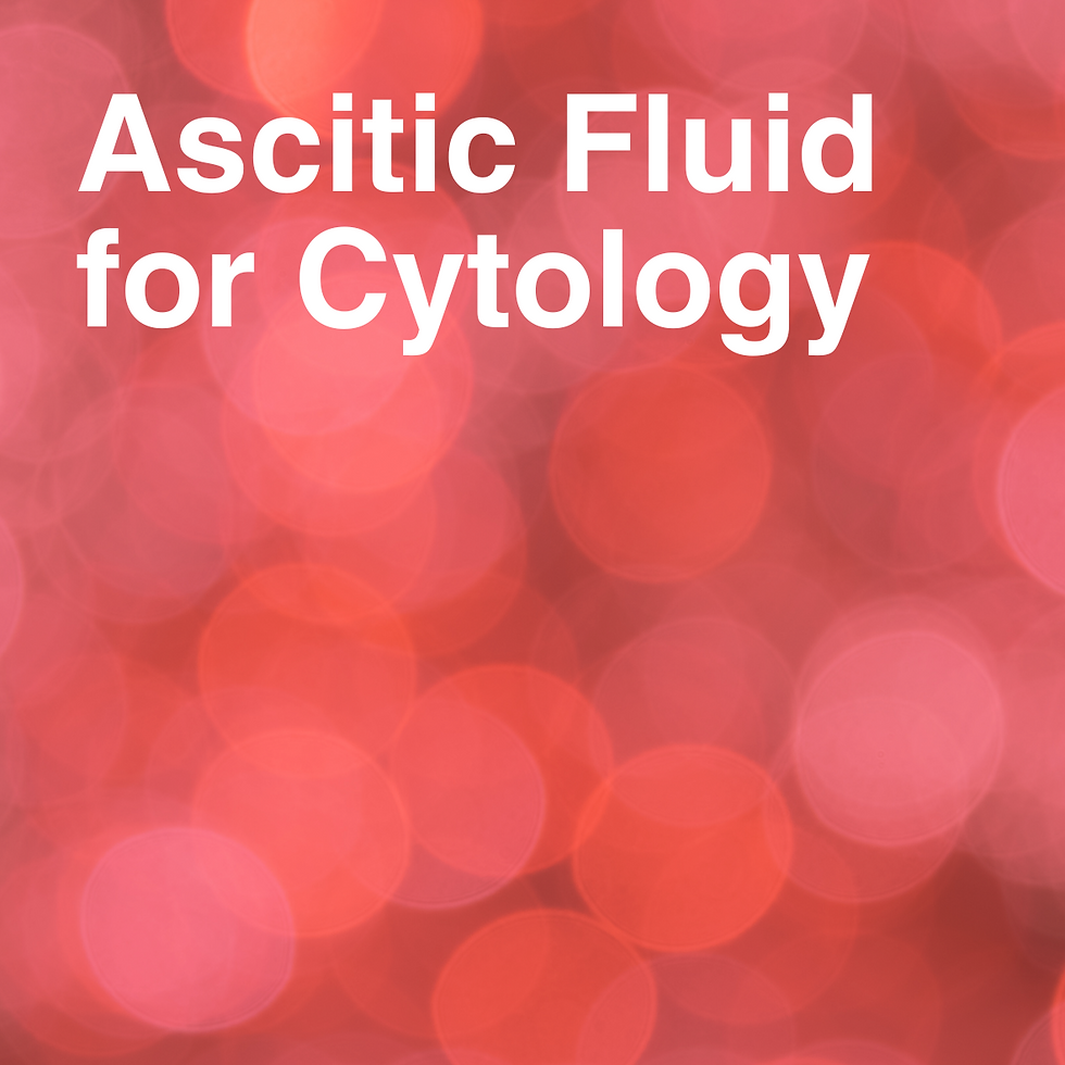 Ascitic Fluid for Cytology