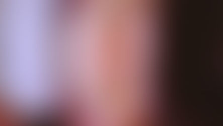 Cracked Tooth: Things To Know