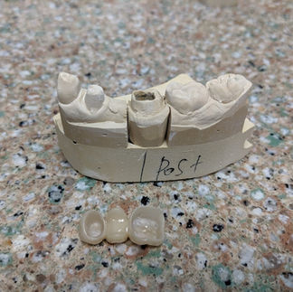 bridge off model