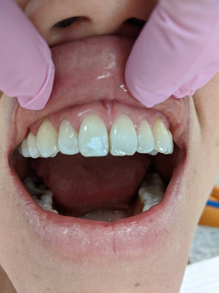 What Is Basic Dental Care What Is Basic Dental Care