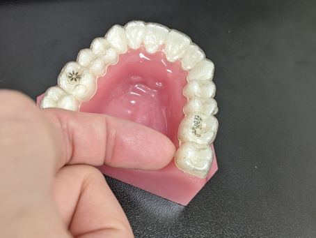 How To Remove Invisalign Trays